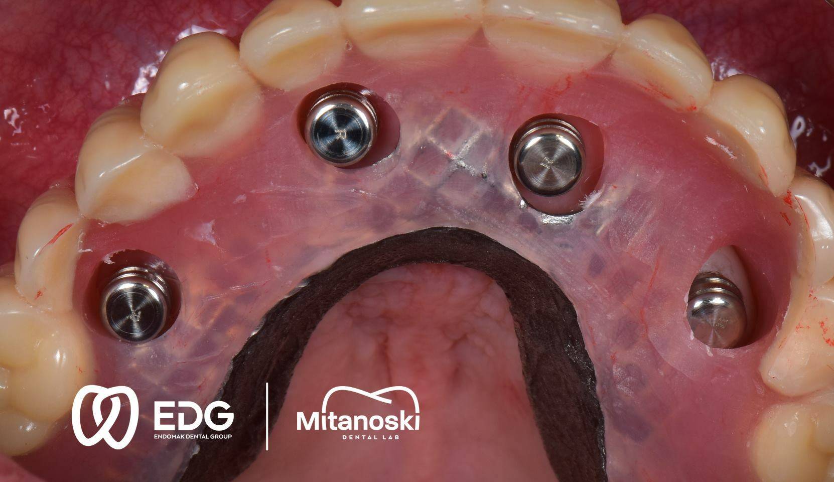 48378569_744816462543433_2181680448193691648_o