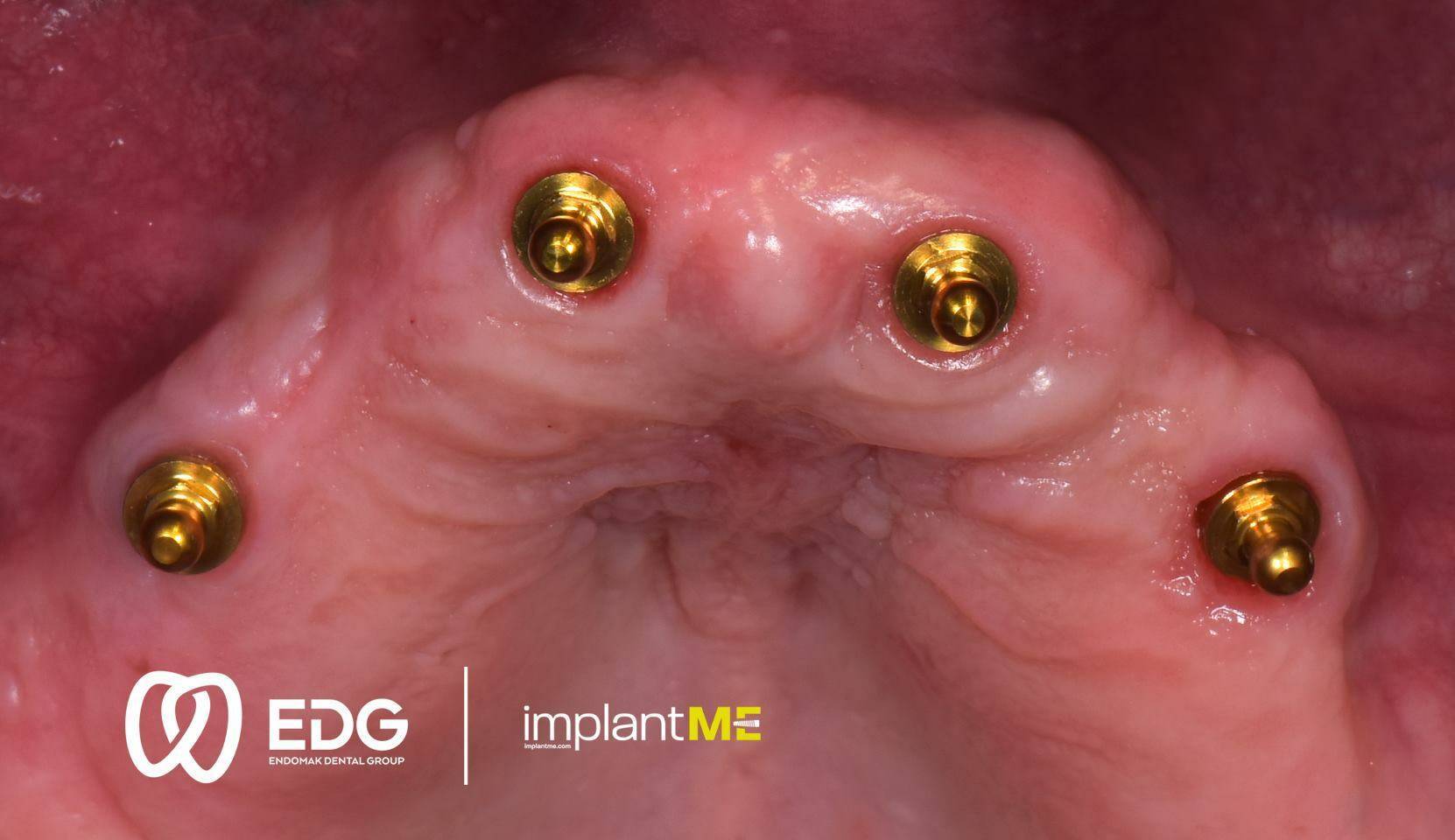 48411630_744816375876775_1482448017079402496_o