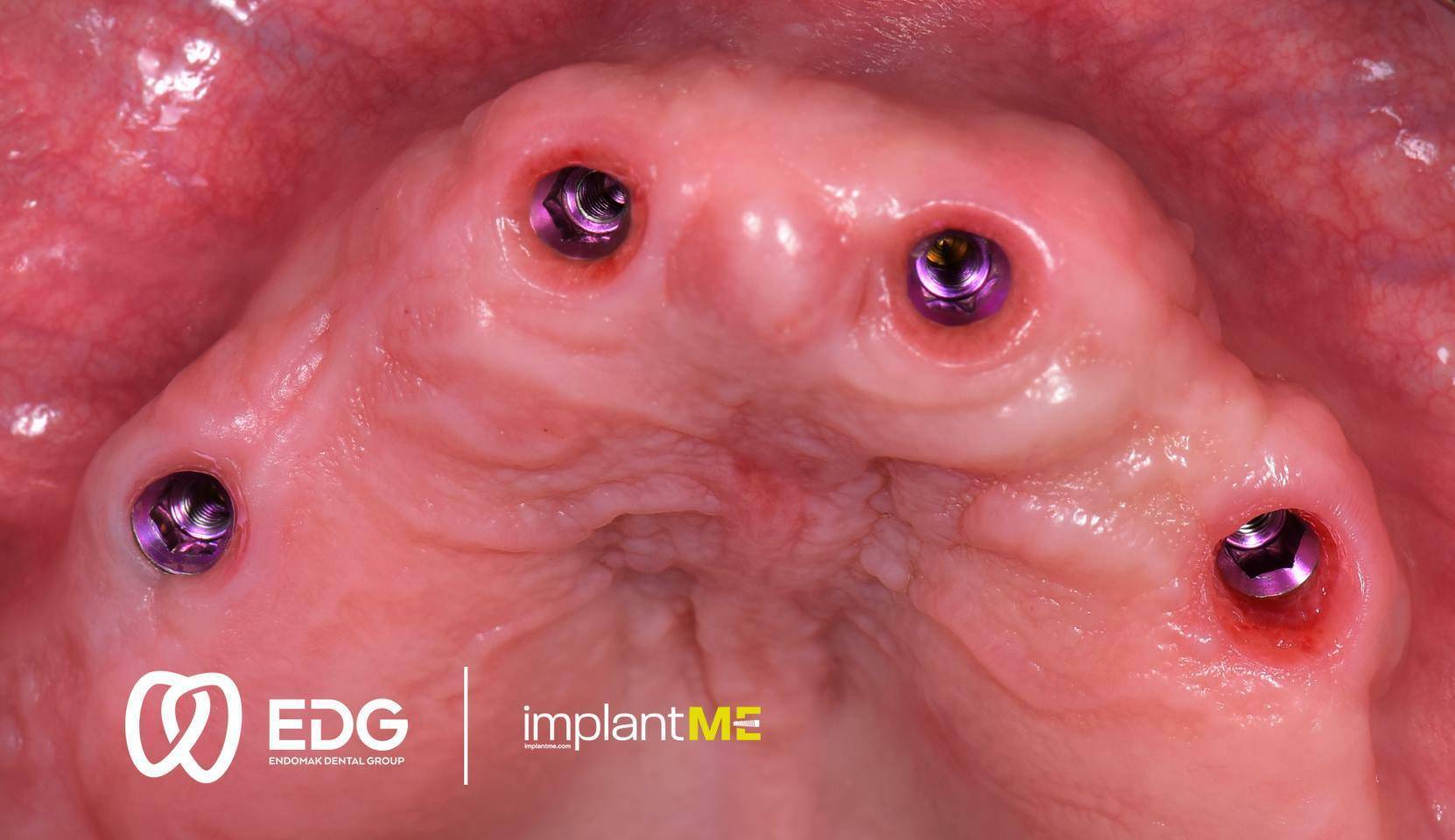 48416690_744816369210109_8443275975831060480_o