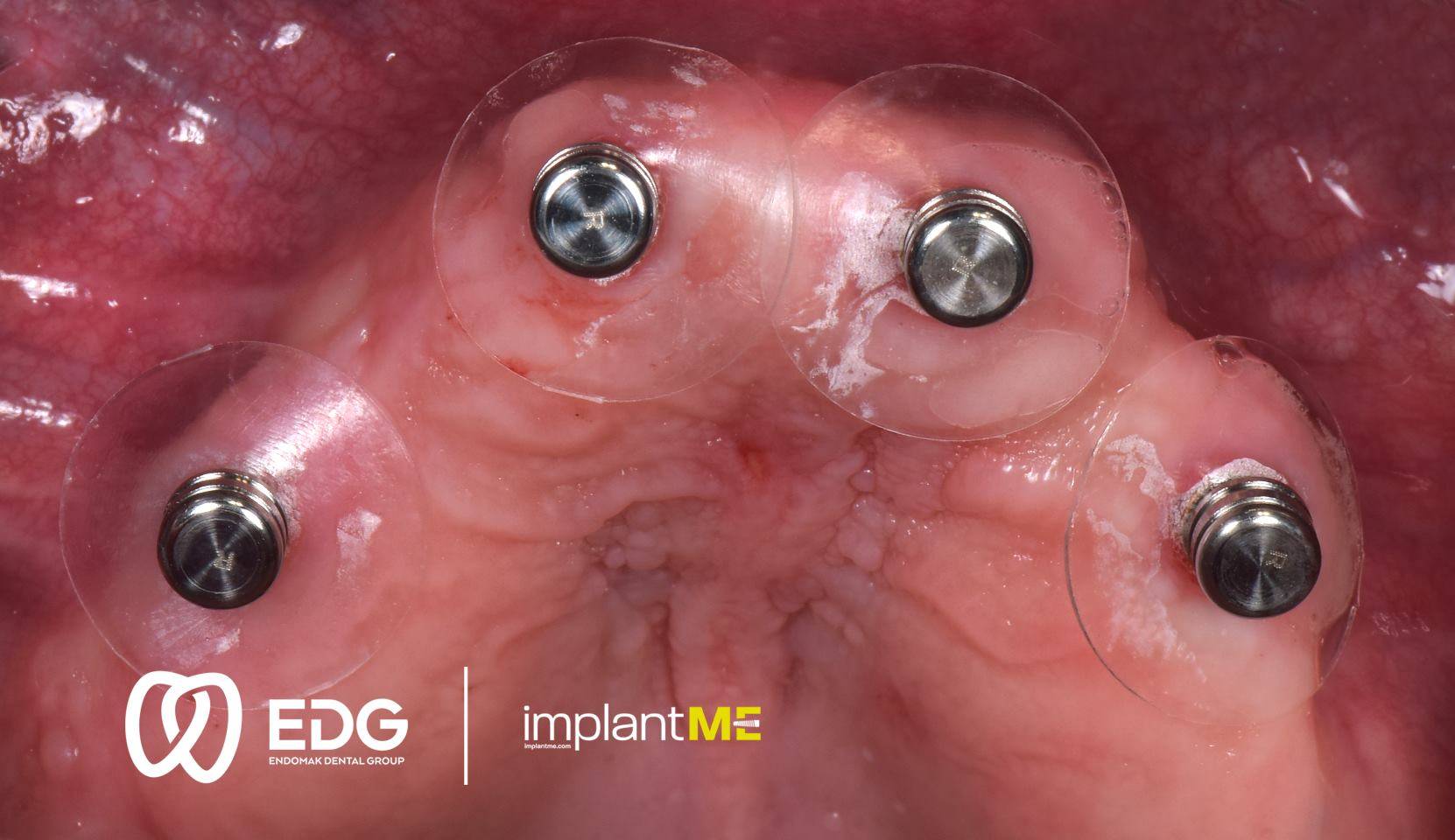 48420819_744816389210107_4834061240122736640_o